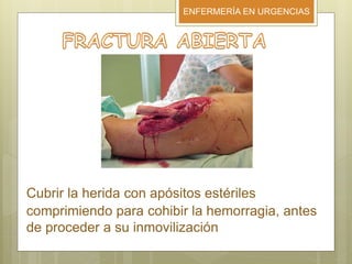 ENFERMERÍA EN URGENCIAS
Cubrir la herida con apósitos estériles
comprimiendo para cohibir la hemorragia, antes
de proceder a su inmovilización
 