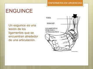 ENFERMERÍA EN URGENCIAS
ENGUINCE
Un esguince es una
lesión de los
ligamentos que se
encuentran alrededor
de una articulación.
 