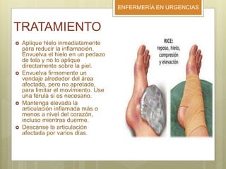 ENFERMERÍA EN URGENCIAS
TRATAMIENTO
 Aplique hielo inmediatamente
para reducir la inflamación.
Envuelva el hielo en un pedazo
de tela y no lo aplique
directamente sobre la piel.
 Envuelva firmemente un
vendaje alrededor del área
afectada, pero no apretado,
para limitar el movimiento. Use
una férula si es necesario.
 Mantenga elevada la
articulación inflamada más o
menos a nivel del corazón,
incluso mientras duerme.
 Descanse la articulación
afectada por varios días.
 
