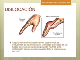 ENFERMERÍA EN URGENCIAS
DISLOCACIÓN
 Separación de dos huesos en el lugar donde se
encuentran en la articulación. Un hueso dislocado es un
hueso que ya no está en su posición normal. Una
dislocación también puede causar daño a ligamentos y
nervios.
 