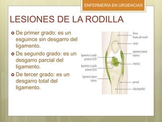 ENFERMERÍA EN URGENCIAS
LESIONES DE LA RODILLA
 De primer grado: es un
esguince sin desgarro del
ligamento.
 De segundo grado: es un
desgarro parcial del
ligamento.
 De tercer grado: es un
desgarro total del
ligamento.
 