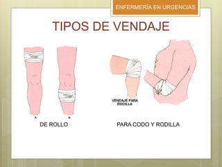 ENFERMERÍA EN URGENCIAS
TIPOS DE VENDAJE
DE ROLLO PARA CODO Y RODILLA
 