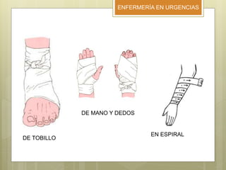 ENFERMERÍA EN URGENCIAS
DE TOBILLO
DE MANO Y DEDOS
EN ESPIRAL
 