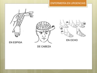 ENFERMERÍA EN URGENCIAS
EN ESPIGA
DE CABEZA
EN OCHO
 