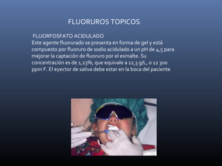FLUORUROS TOPICOS
FLUORFOSFATO ACIDULADO
Este agente fluorurado se presenta en forma de gel y está
compuesto por fluoruro de sodio acidulado a un pH de 4,5 para
mejorar la captación de fluoruro por el esmalte. Su
concentración es de 1,23%, que equivale a 12,3 g/L, o 12 300
ppm F. El eyector de saliva debe estar en la boca del paciente
 