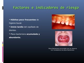 Factores e indicadores de riesgo


 Hábitos poco frecuentes de
higiene bucal.
 Inicio tardío del cepillado de
dientes.
 Placa bacteriana acumulada y
abundante.




                                   Placa Bacteriana acumulada que se observa
                                       con reveladores de placa bacteriana.
 