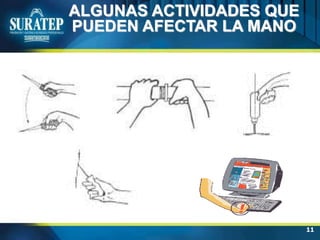 11
ALGUNAS ACTIVIDADES QUE
PUEDEN AFECTAR LA MANO
 