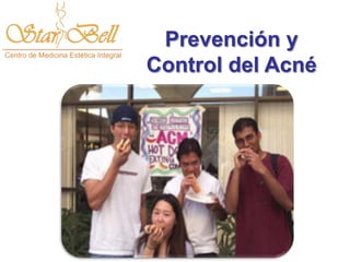 Prevención y
Control del Acné
 