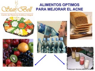 ALIMENTOS OPTIMOS
PARA MEJORAR EL ACNE
 