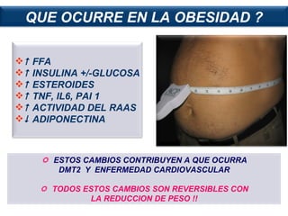    FFA    INSULINA +/-GLUCOSA    ESTEROIDES     TNF, IL6, PAI 1    ACTIVIDAD DEL RAAS    ADIPONECTINA    ESTOS CAMBIOS CONTRIBUYEN A QUE OCURRA DMT2  Y  ENFERMEDAD CARDIOVASCULAR    TODOS ESTOS CAMBIOS SON REVERSIBLES CON LA REDUCCION DE PESO !! QUE OCURRE EN LA OBESIDAD ? 
