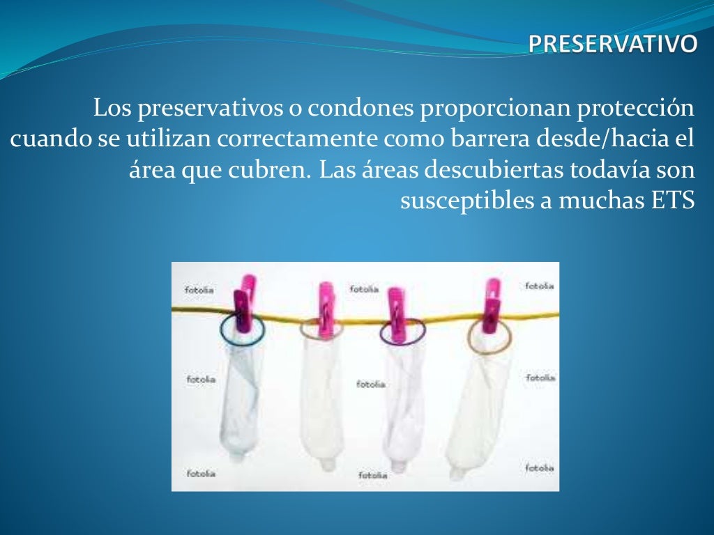 Prevencion ets