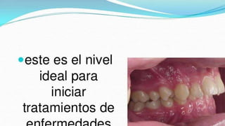 PREVENCION I ISTP.pptx