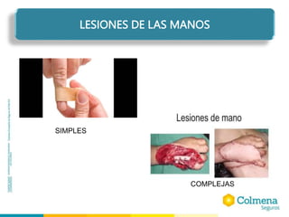 LESIONES DE LAS MANOS
SIMPLES
COMPLEJAS
 