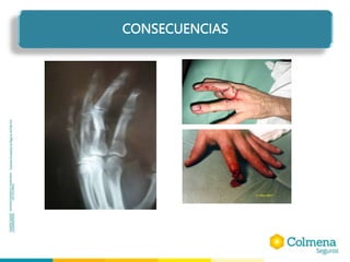 CONSECUENCIAS
 