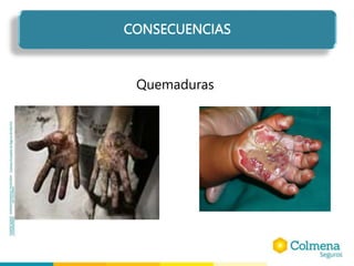 CONSECUENCIAS
Quemaduras
 