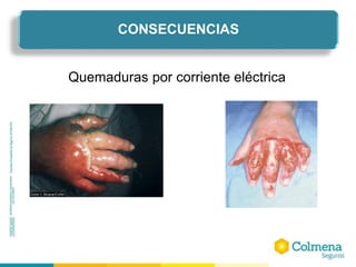 Quemaduras por corriente eléctrica
CONSECUENCIAS
 