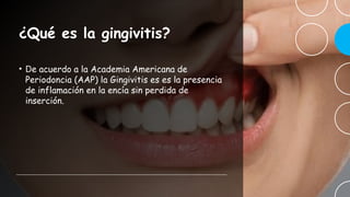 Prevencion y control de la enfermedad periodontal con enfasis en ...