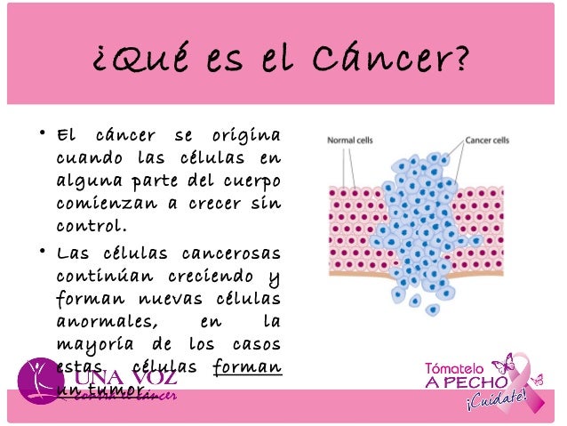 El aumento del pecho de vangi
