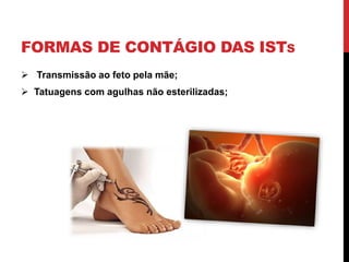FORMAS DE CONTÁGIO DAS ISTS
 Transmissão ao feto pela mãe;
 Tatuagens com agulhas não esterilizadas;
 