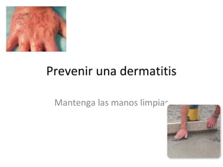 Prevenir una dermatitis
Mantenga las manos limpias
 