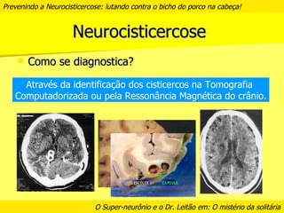 Prevenindo a neurocisticercose | PPT
