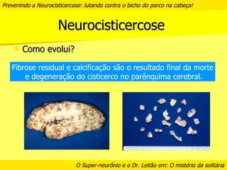 Prevenindo a neurocisticercose | PPT
