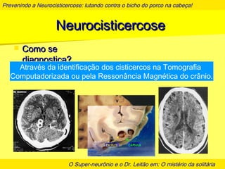 Prevenindo a Neurocisticercose: lutando contra o bicho do porco na cabeça!
O Super-neurônio e o Dr. Leitão em: O mistério da solitária
NeurocisticercoseNeurocisticercose
 Como seComo se
diagnostica?diagnostica?
Através da identificação dos cisticercos na Tomografia
Computadorizada ou pela Ressonância Magnética do crânio.
 
