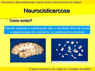 Prevenindo a Neurocisticercose: lutando contra o bicho do porco na cabeça!
O Super-neurônio e o Dr. Leitão em: O mistério da solitária
NeurocisticercoseNeurocisticercose
 Como evolui?Como evolui?
Fibrose residual e calcificação são o resultado final da morte
e degeneração do cisticerco no parênquima cerebral.
 