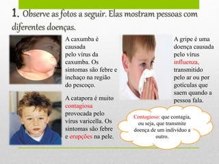 1. Observe as fotos a seguir. Elas mostram pessoas com
diferentes doenças.
A caxumba é
causada
pelo vírus da
caxumba. Os
sintomas são febre e
inchaço na região
do pescoço.
A gripe é uma
doença causada
pelo vírus
influenza,
transmitido
pelo ar ou por
gotículas que
saem quando a
pessoa fala.A catapora é muito
contagiosa
provocada pelo
vírus varicella. Os
sintomas são febre
e erupções na pele.
Contagioso: que contagia,
ou seja, que transmite
doença de um indivíduo a
outro.
 