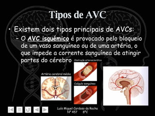 Tipos de AVC Existem dois tipos principais de AVCs:  O  AVC isquémico  é provocado pelo bloqueio de um vaso sanguíneo ou de uma artéria, o que impede a corrente sanguínea de atingir partes do cérebro.  Artéria cerebral média Obstrução arterosclerótica Coágulo sanguíneo 