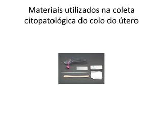 Materiais utilizados na coleta
citopatológica do colo do útero
 