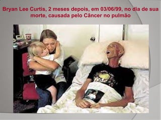 Bryan Lee Curtis, 2 meses depois, em 03/06/99, no dia de sua
          morte, causada pelo Câncer no pulmão
 
