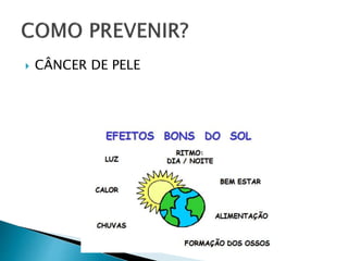  CÂNCER DE PELE
 