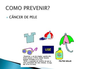  CÂNCER DE PELE
 