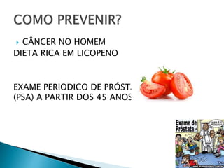  CÂNCER NO HOMEM
DIETA RICA EM LICOPENO
EXAME PERIODICO DE PRÓSTATA E SANGUE
(PSA) A PARTIR DOS 45 ANOS
 