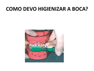 COMO DEVO HIGIENIZAR A BOCA?
 