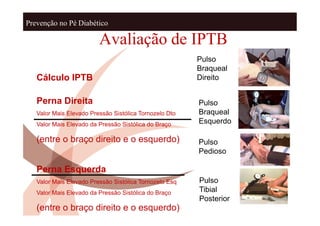 Prevenção no Pé Diabético

                         Avaliação de IPTB
                                                        Pulso
                                                        Braqueal
   Cálculo IPTB                                         Direito


   Perna Direita                                        Pulso
   Valor Mais Elevado Pressão Sistólica Tornozelo Dto   Braqueal
   Valor Mais Elevado da Pressão Sistólica do Braço     Esquerdo

   (entre o braço direito e o esquerdo)                 Pulso
                                                        Pedioso

   Perna Esquerda
   Valor Mais Elevado Pressão Sistólica Tornozelo Esq   Pulso
   Valor Mais Elevado da Pressão Sistólica do Braço     Tibial
                                                        Posterior
   (entre o braço direito e o esquerdo)
 
