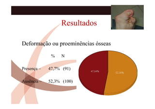 Resultados

Deformação ou proeminências ósseas

              %   N

Presença –   47,7% (91)

Ausência –   52,3% (100)
 
