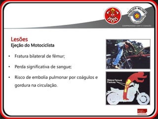• Fratura bilateral de fêmur;
• Perda significativa de sangue;
• Risco de embolia pulmonar por coágulos e
gordura na circulação.
Ejeção do Motociclista
Lesões
 