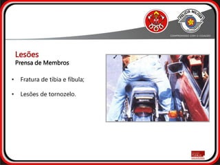 • Fratura de tíbia e fíbula;
• Lesões de tornozelo.
Prensa de Membros
Lesões
 