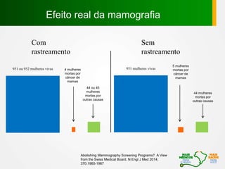 Efeito real da mamografia
951 ou 952 mulheres vivas 4 mulheres
mortas por
câncer de
mamas
44 ou 45
mulheres
mortas por
outras causas
Com
rastreamento
44 mulheres
mortas por
outras causas
5 mulheres
mortas por
câncer de
mamas
951 mulheres vivas
Sem
rastreamento
Abolishing Mammography Screening Programs? A View
from the Swiss Medical Board. N Engl J Med 2014;
370:1965-1967
 