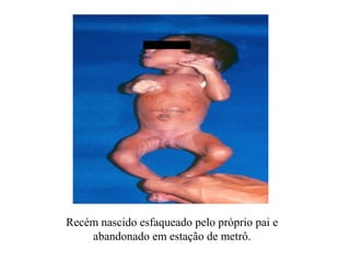Recém nascido esfaqueado pelo próprio pai e
    abandonado em estação de metrô.
 