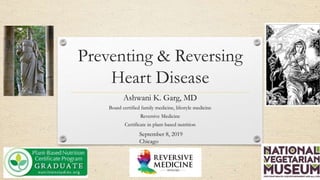 Preventing & Reversing
Heart Disease
Ashwani K. Garg, MD
Board certified family medicine, lifestyle medicine
Reversive Medicine
Certificate in plant-based nutrition
September 8, 2019
Chicago
 