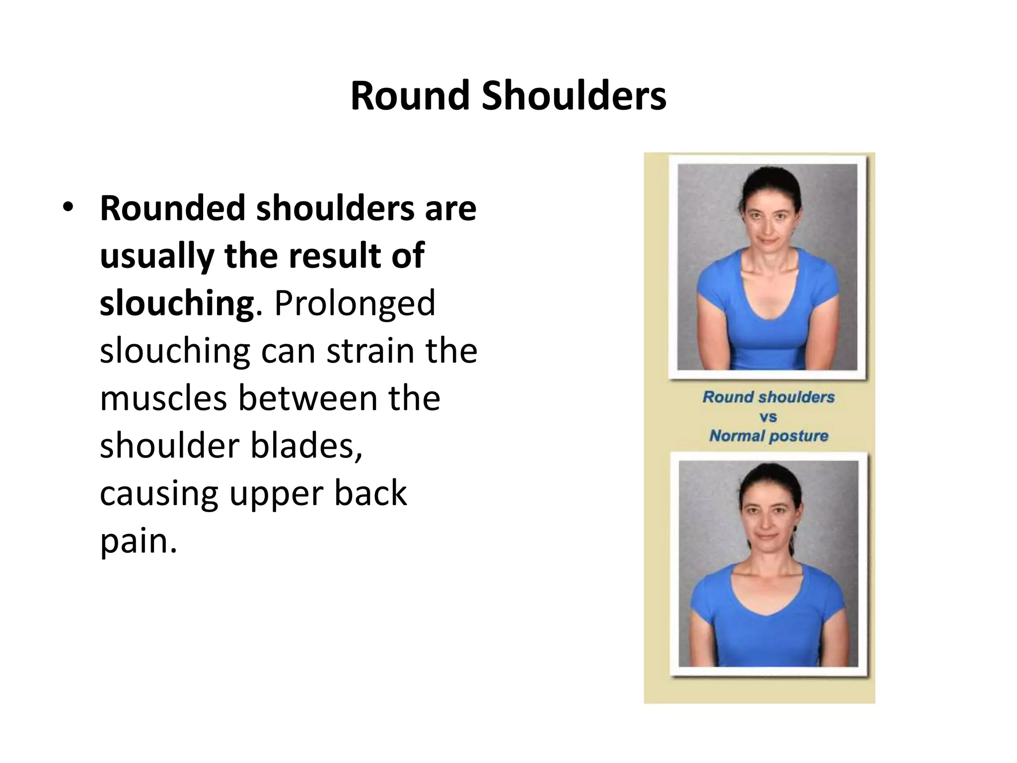 Round Shoulders
• Rounded shoulders are
usually the result of
slouching. Prolonged
slouching can strain the
muscles between the
shoulder blades,
causing upper back
pain.
 