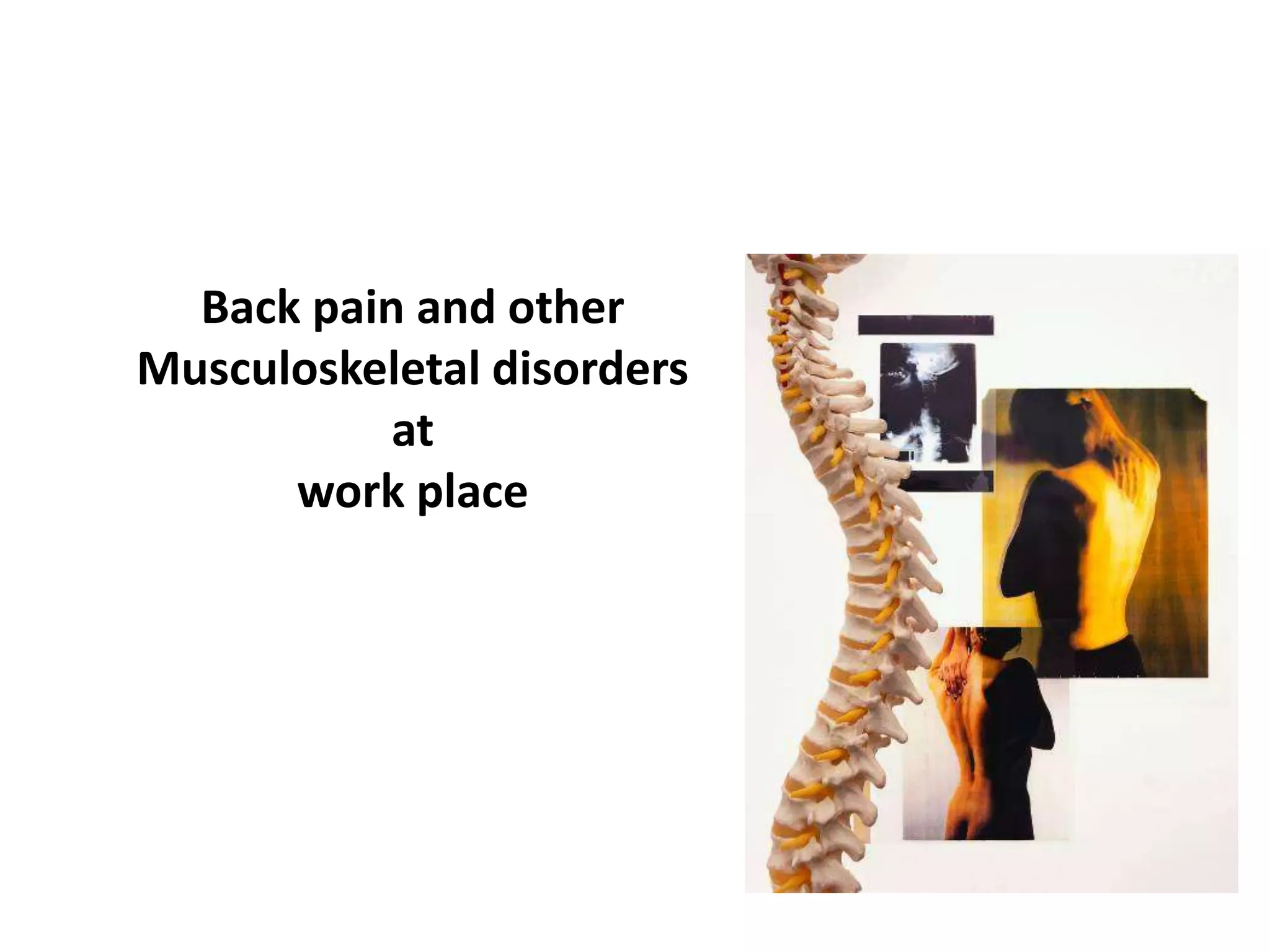 Back pain and other
Musculoskeletal disorders
at
work place
 