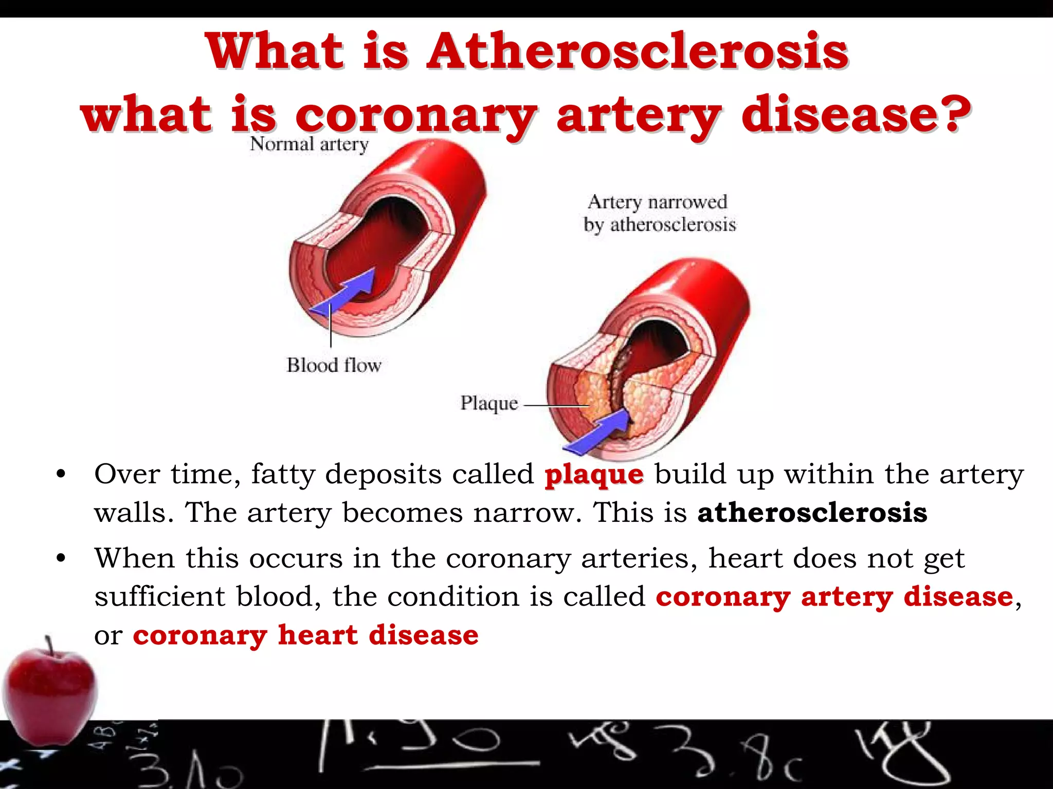 Preventing Heart Disease