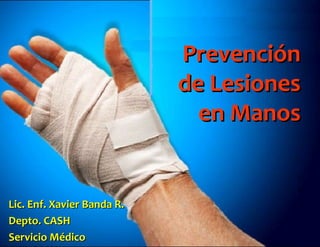 Prevención
                            de Lesiones
                              en Manos


Lic. Enf. Xavier Banda R.
Depto. CASH
Servicio Médico
 