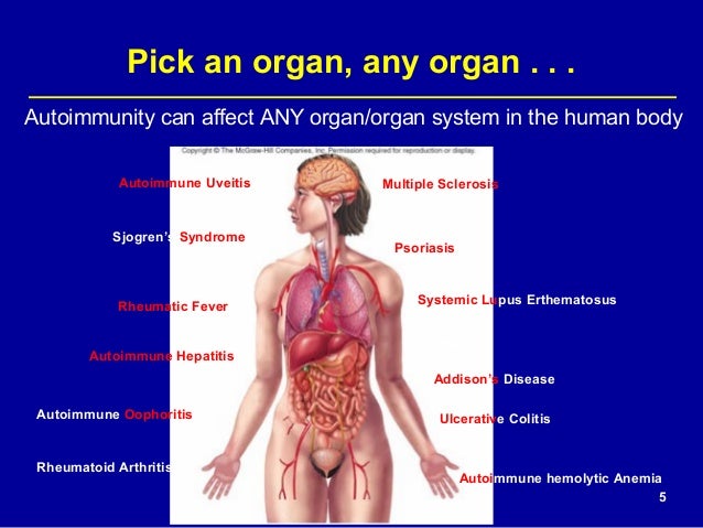 Preventing infections in patients with autoimmune diseases 