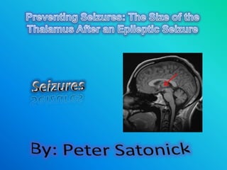 Preventing Seizures: The Size of the Thalamus After an Epileptic Seizure Seizures By: Peter Satonick 