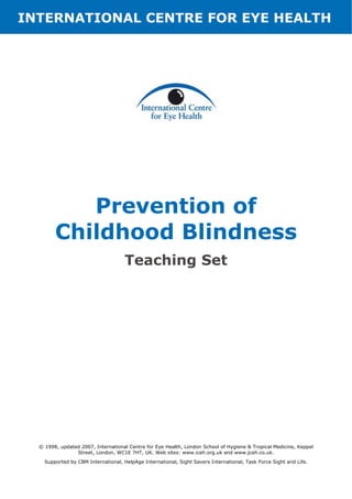 INTERNATIONAL CENTRE FOR EYE HEALTH
Prevention of
Childhood Blindness
Teaching Set
© 1998, updated 2007, International Centre for Eye Health, London School of Hygiene & Tropical Medicine, Keppel
Street, London, WC1E 7HT, UK. Web sites: www.iceh.org.uk and www.jceh.co.uk.
Supported by CBM International, HelpAge International, Sight Savers International, Task Force Sight and Life.
 